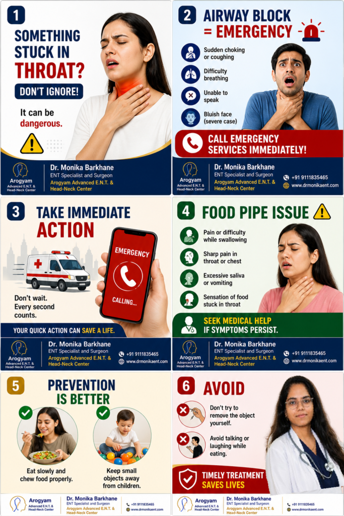 Foreign Body in Throat – Know the Signs, Act Fast