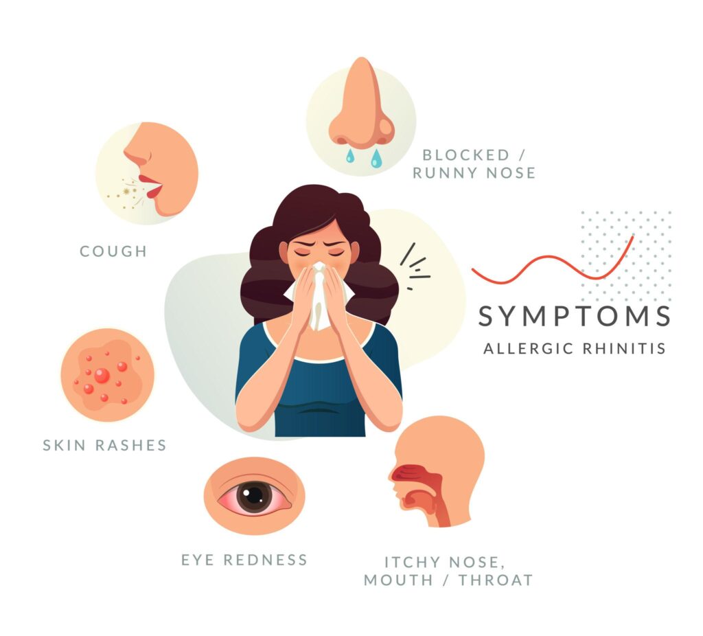allergic rhinitis symptoms allergic rhinitis treatment allergic rhinitis causes allergic rhinitis in children allergic rhinitis vs common cold seasonal allergic rhinitis perennial allergic rhinitis hay fever (allergic rhinitis) chronic allergic rhinitis