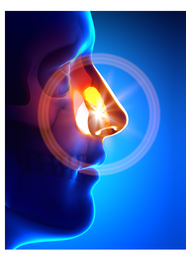 Foreign Body in the Nose Dr. Monika Barkhane